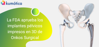La FDA aprueba los implantes de reconstrucción pélvica impresos en 3D de Onkos Surgical