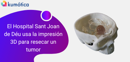 El Hospital Sant Joan de Déu Barcelona utiliza la impresión 3D para resecar un tumor